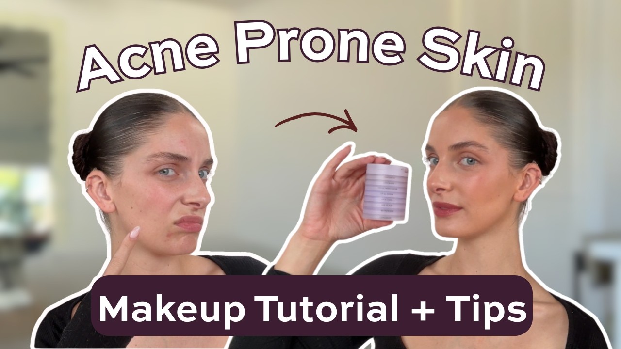 Everyday Makeup for Dry Acne Prone Skin - YouTube