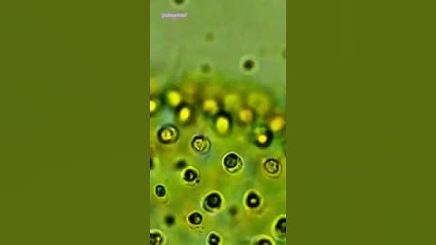 Volvox #volvox #algae #bscbotany  #neet #pgtbiology #closeintel  #greenalgae #microscope #coenobium