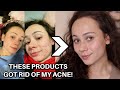 HOW I GOT RID OF MY ACNE! The Best Skincare Routine I've Ever Had