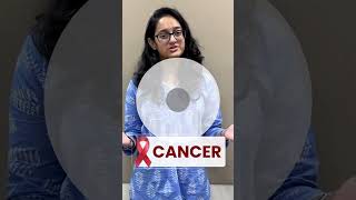 Reliance Nippon Life Cancer Protection Plus.