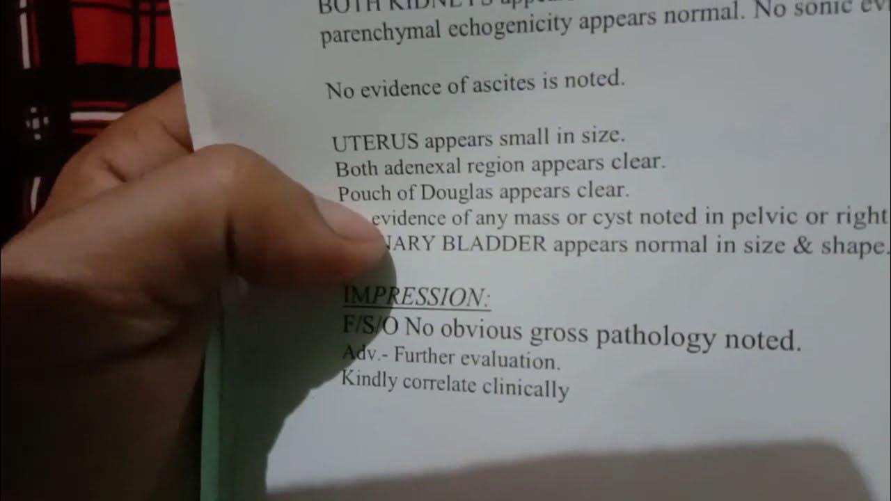 How To Read Ultrasounds (USG) At Home घर पर अल्ट्रासाउंड कैसे पढ़े