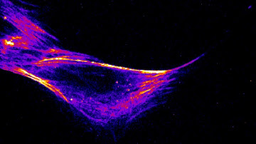 Inner Movement of the Cell - Actin Flux Visualised with SiR-Actin
