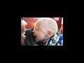 Albinism #viral #trending #facts #albinism #africa