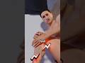 What to do if you have a sprained leg #shorts #youtubeshorts #shortsvideo #vairalshort