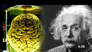 How to Albert Einstein Brain is Really Different Than Others