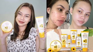 Megan Poreless White Sunflower Line Product Review | Amy Talaboc