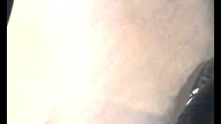 SDV 0326