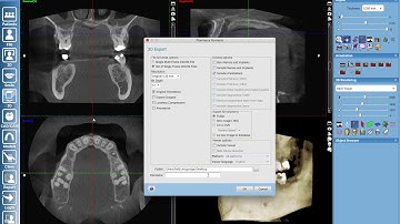 How to export your 3D Volume from Romexis