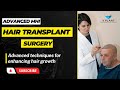 Hair transplant advanced techniques for enhancing hair growth  mhi hair transplant