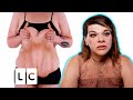 Woman Loses 162 lbs As A Promise To Her Son | My Extreme Excess Skin