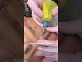 Why Do Specialists Never Skip This Unusual Step? #shortvideo