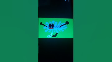 (NOT MY VIDEO)3rd Source Of What Happens If EmilianoYTP With a broken leg watches x