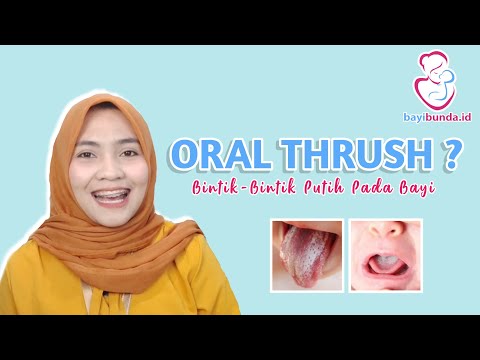 Video: Thrush Pada Kanak-kanak: Apa Yang Menyebabkannya Dan Bagaimana Menanganinya