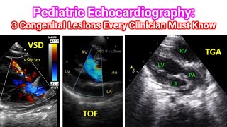 Pediatric Echocardiography: 3 Congenital Lesions Every Clinician Must Know