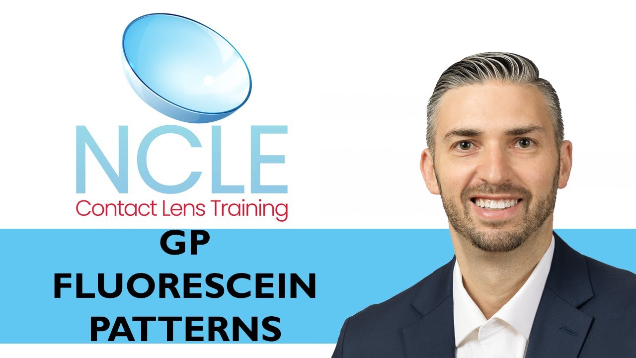 NCLE GP FLUORESCEIN PATTERNS YouTube