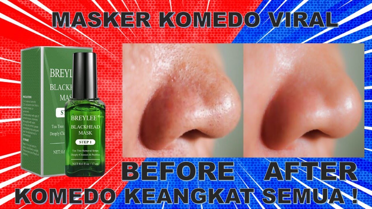 Pin Oleh Putri Di Skincare Di 2020 Produk Perawatan Kulit Alami Perawatan Kulit Produk Perawatan Kulit