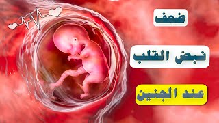 متى يكون نبض الجنين ضعيف ؟