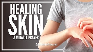 Prayer For Skin Healing | Acne, Allergy, Pimples, Eczema, Disease, All Problems