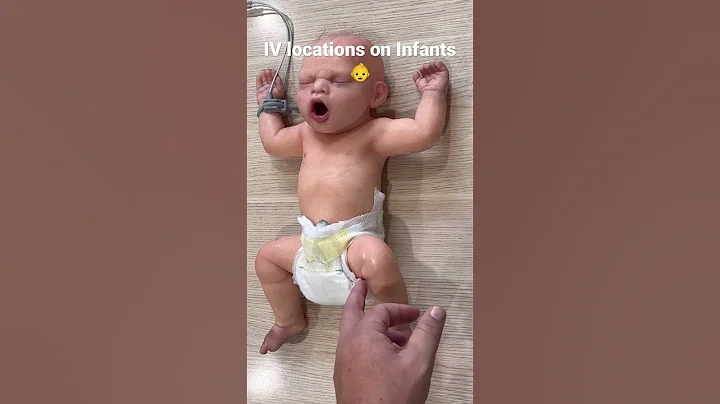 IV locations on Infants #paramedic #emt #paramedicos #ems #paramediclife #paramedicstudent