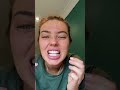 It’s Invisalign try change day!! Week 2 trays going in gang!! These bad bois are tight!! #invisalign