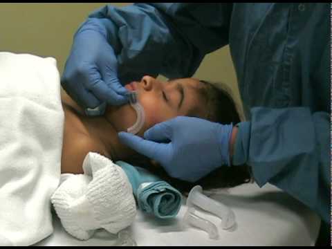 Pediatric Oropharyngeal Airway sizing - YouTube