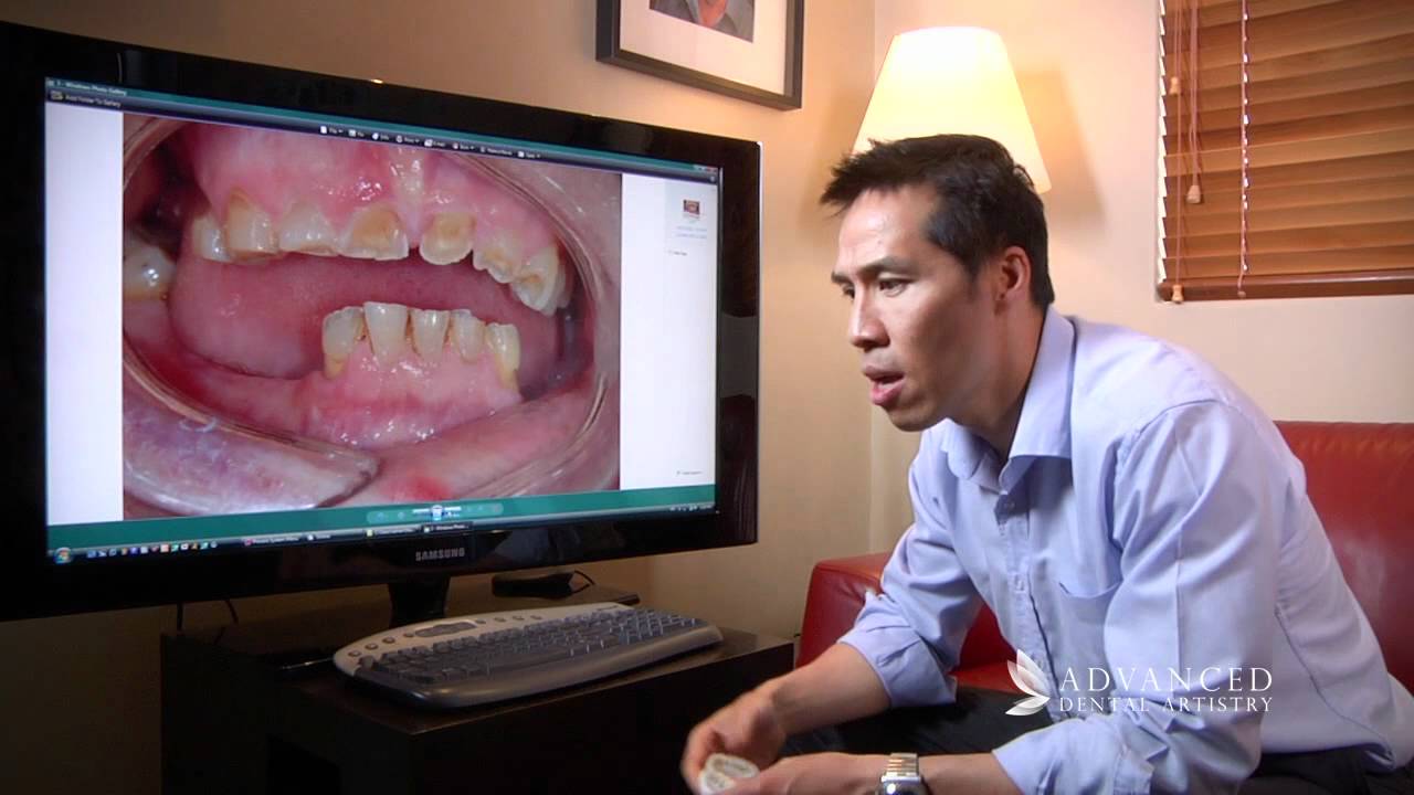 Advanced Dental Artistry - Snap-On-Smile - Perth Cosmetic and Dental Implant Team