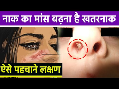 वीडियो: मांस भरने के साथ प्रोफिटरोल