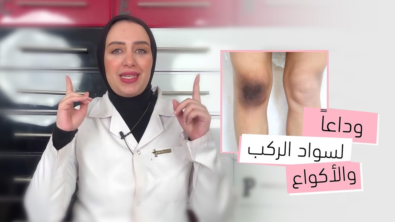 أفضل طرق تفتيح الركب والاكواع 💃 وداعًا لسواد الركب والأكواع 👑