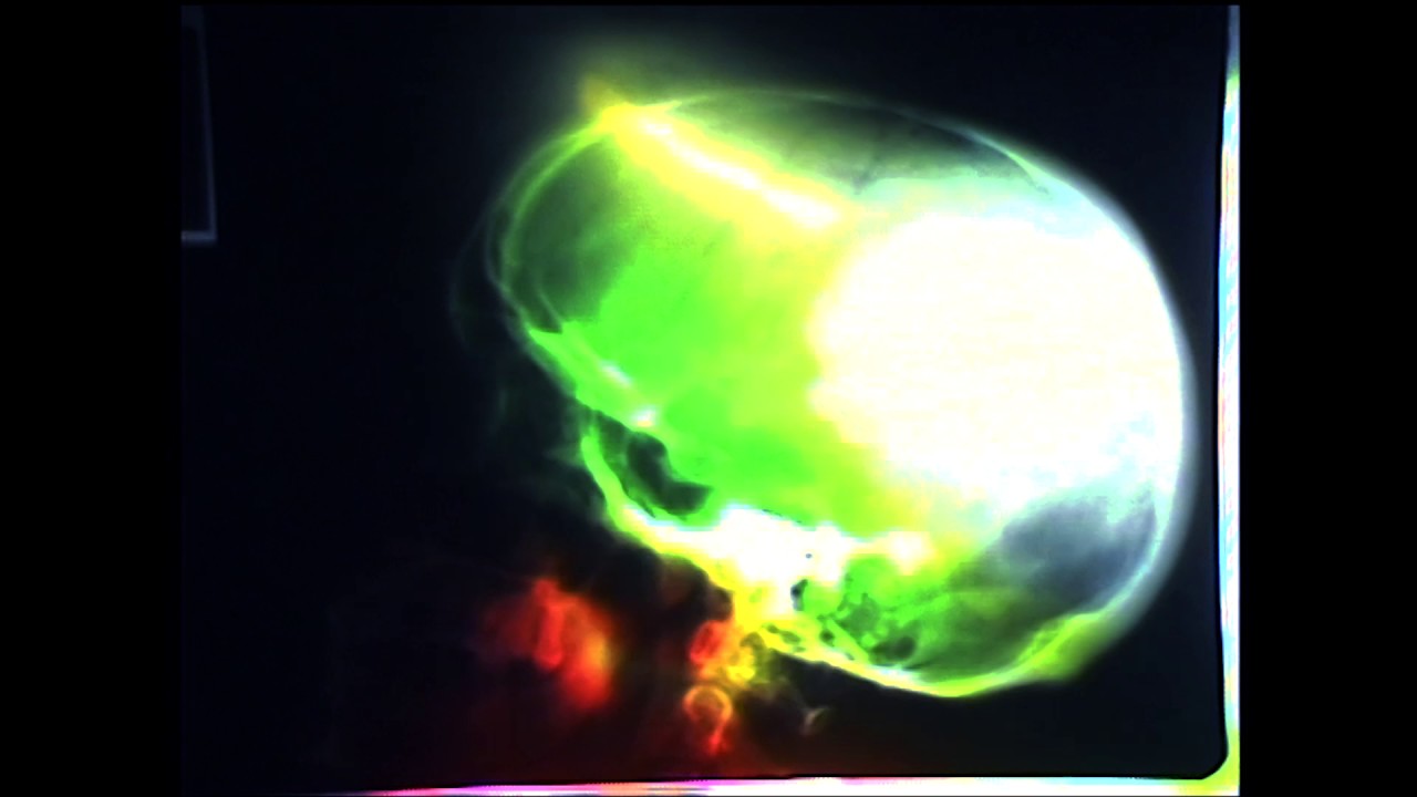 Paraguaii - Dream About The Things You Never Do (Official Video)