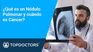 ¿Qué es un Nódulo Pulmonar y cuándo es Cáncer?