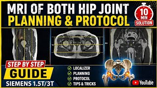 How to Do MRI Hips on Siemens: Patient Setup, Coil Selection, Sequences Explained