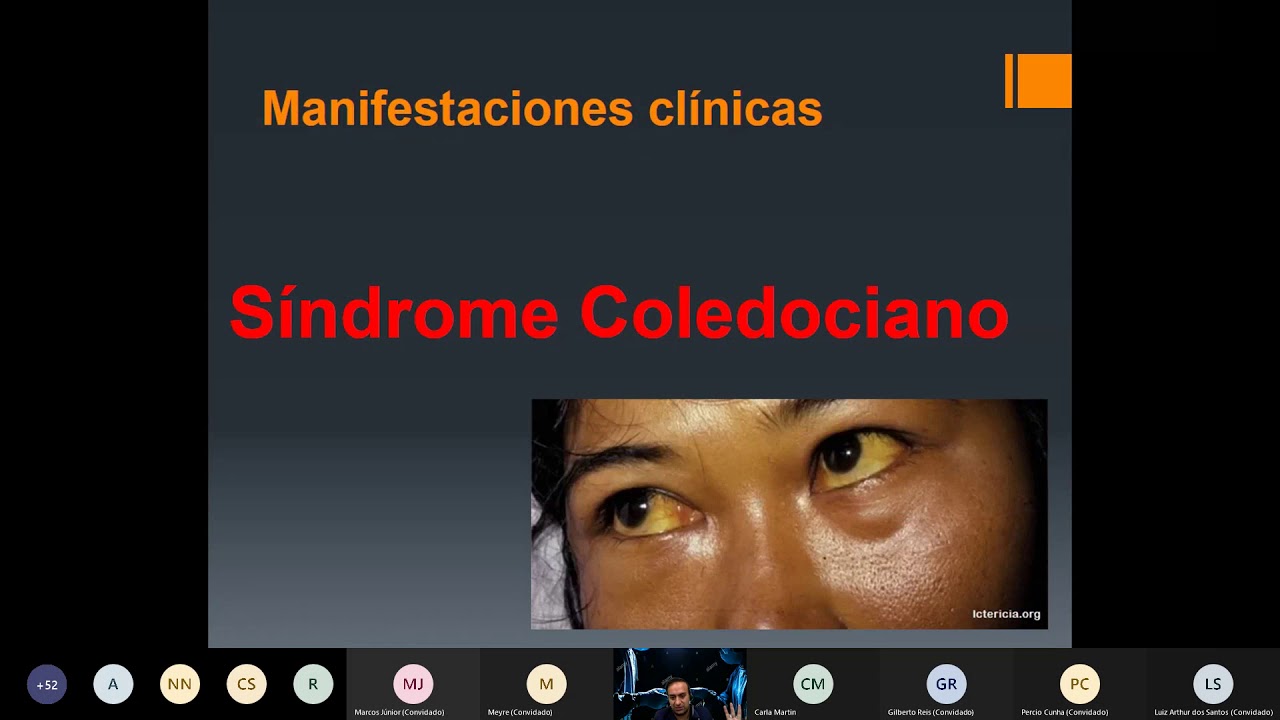 Litisis Coledociana y Colangitis  2/3