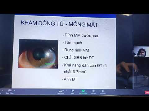 Video: Cách chuẩn bị tinh thần cho cuộc phẫu thuật: 8 bước (có hình ảnh)