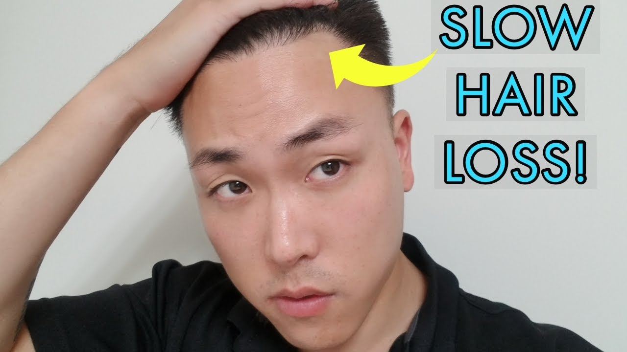 TOP 3 THINGS TO AVOID TO SLOW HAIR LOSS! - YouTube