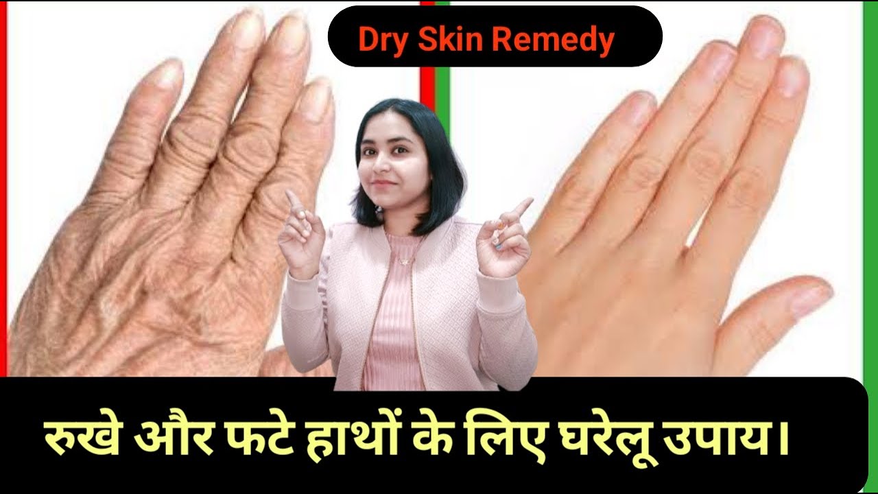 dry-skin-remedy-and-instructions