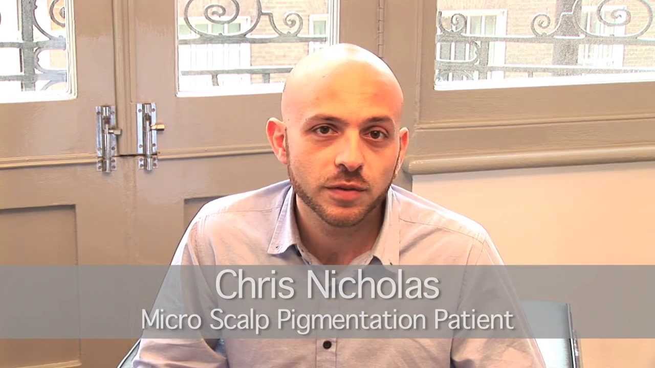 Scalp Micropigmentation London  SMP in London  Hair Tattoo London