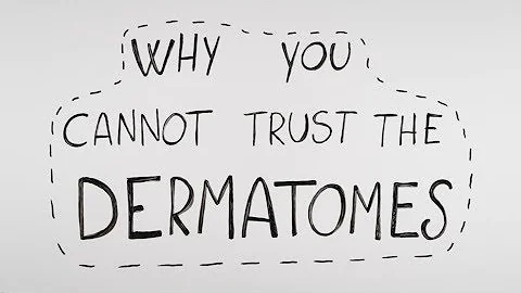 Why you cannot trust the dermatomes