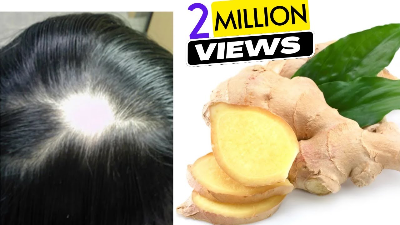 Ginger Juice to Cure Baldness & Regrow New Hair | Sushmita's Diaries -  YouTube