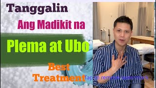 Tanggal ang PLEMA at UBO by Doc Jun. The Best Way to Remove Phlegm the Natural Way.