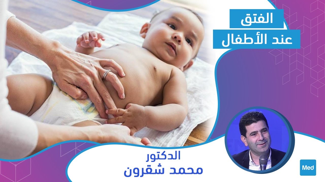 Dr Mohamed Chakroun  - الفتق عند الأطفال