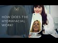 How does the hydrafacial work