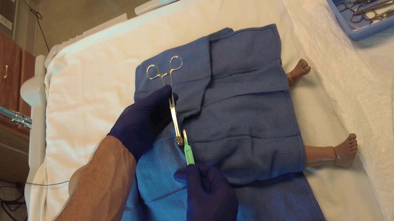 Umbilical Line Placement POV YouTube