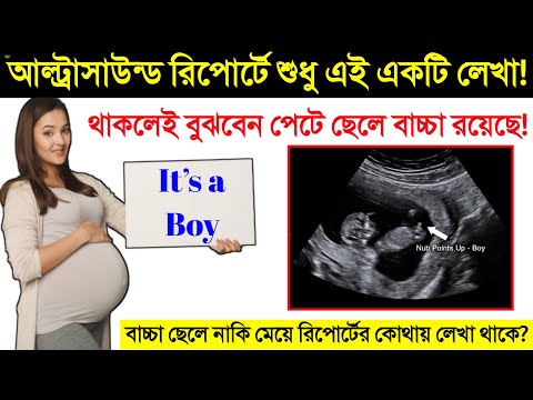 ভিডিও: একটি আল্ট্রাসাউন্ড ছবি কিভাবে পড়বেন: 9 টি ধাপ (ছবি সহ)