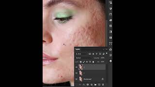 Remove Skin Blemishes in Photoshop - Tutorial !   #shorts #photoshop
