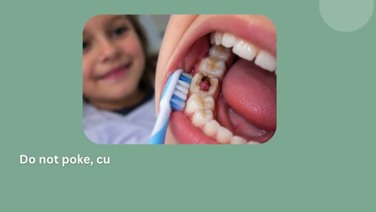 ⁣Pulp Polyps in Kids