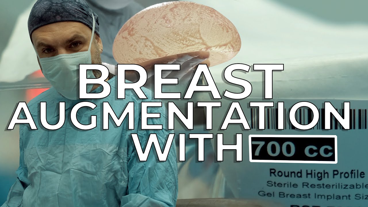 I Placed A New 700cc Implant BreastAugmentation ImplantSurgery YouTube i-placed-a-new-700cc-implant-breastaugmentation-implantsurgery-youtube
