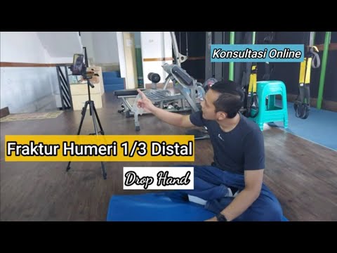 latihan pasca operasi ||fraktur humeri 1/3 distal sinistra ||drop hand ||ivanphysio