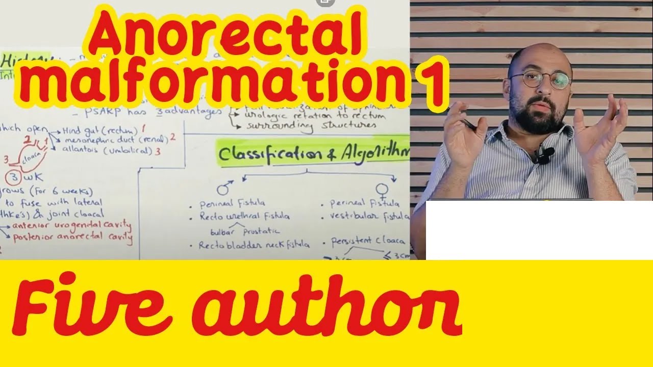 Ep 1 - Anorectal Malformation  -  Five Authors انسداد فتحة الشرج شرح تفصيلي || Dr. Khaled Salah