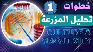 41_كيفية عمل تحليل المزرعة culture و انواع العينات المستخدمة !!!!