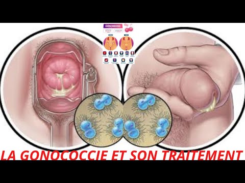 Vidéo: Quelles maladies contractent les pivoines ?